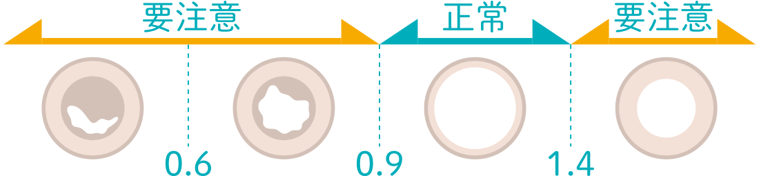 血管の詰まりのイメージ図。0.9~1.4までの範囲は正常