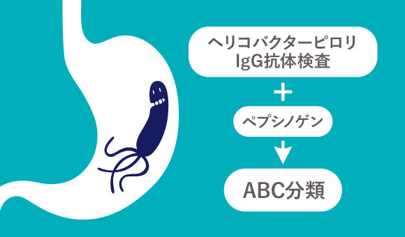 胃がんリスク検査（ヘリコバクターピロリIgG抗体検査 + ペプシノゲン = ABC分類）